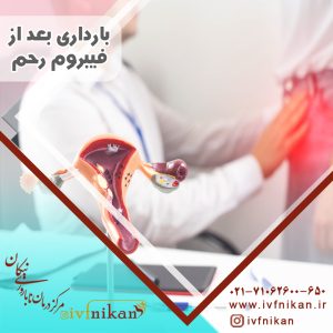 نکات مهم در مورد فیبروم رحم